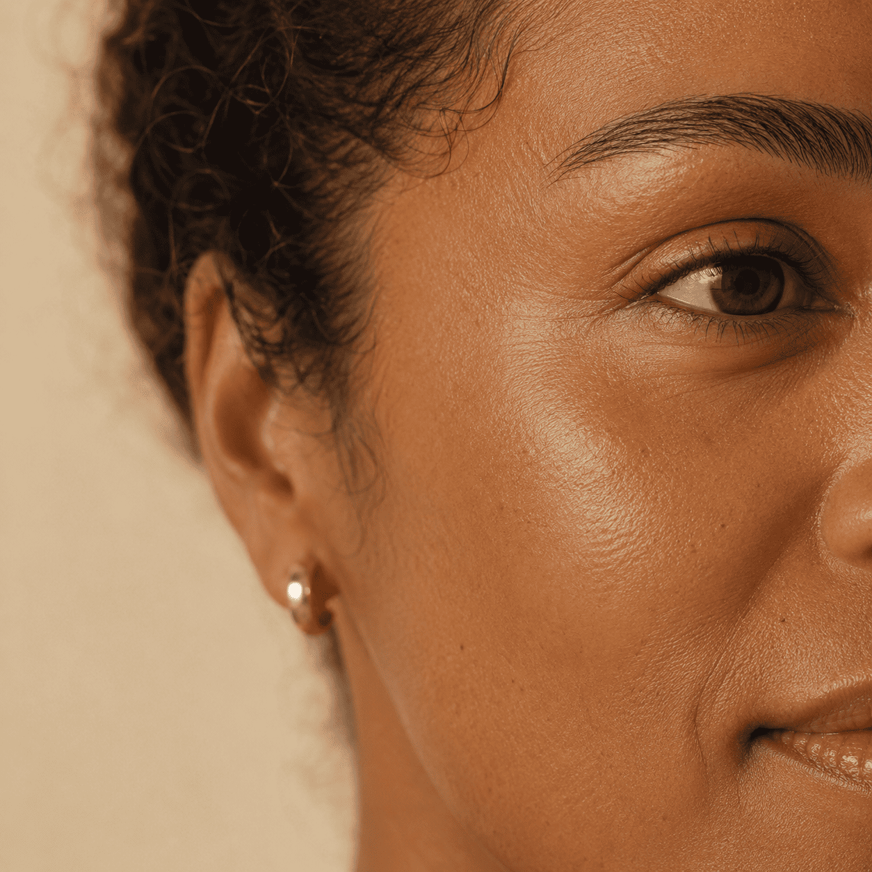 Modelo ilustrativa — região da maçã do rosto, referência de tratamento de manchas e melasma